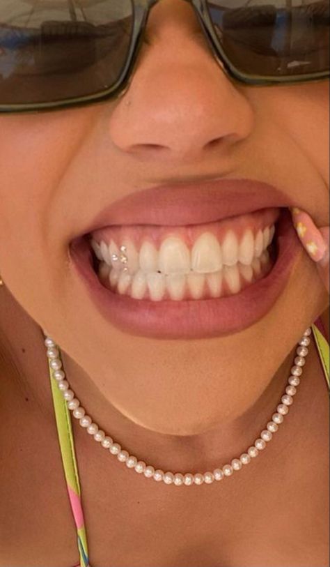 Pretty Teeth, Dental Jewelry, Grillz Teeth, Tooth Jewelry, Diamond Teeth, Tooth Gems, Grills Teeth, Trendy Products, Perfect Teeth