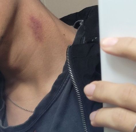 Hickey On Boy, Korean Guy Aesthetic, Hickies Neck Aesthetic Guy, Hicks On Neck, Hickies Neck, Korean Guy, Guy Aesthetic, Kiss Mark, Boyfriend Pranks Pictures