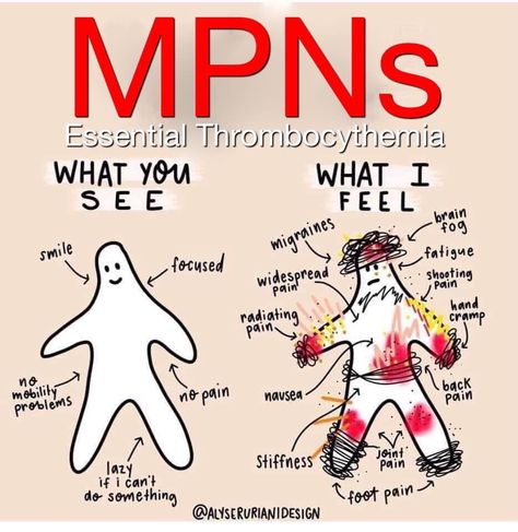 Essential Thrombocytosis, Essential Thrombocythemia, Myeloproliferative Neoplasms, Medical Laboratory, Health Research, Foot Pain, Health Conditions, Interesting Stuff, True Story