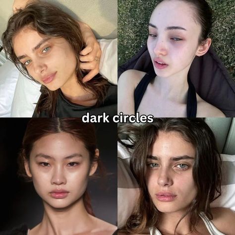 Models With Dark Circles, Sculpted Face Aesthetic, Round Face Insecurity, Dark Circle Aesthetic, Teeth Insecurity, Nose Insecurity, Roman Nose Women, Pretty Insecurities, Dark Woman Aesthetic