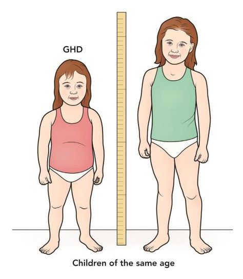 Most children with growth hormone deficiency grow less than 2 inches per year, but in this case the child on the left is much shorter than a child of the same age Pituitary Gland Tumor, Deficiency Symptoms, Pituitary Gland, Bone Strength, Growth Factor, Healthy Eating For Kids, Hormone Health, Feel Younger, Growth Hormone