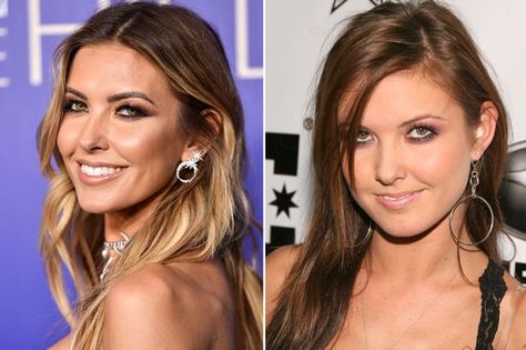 Audrina Patridge's changing face - How The Hills star ... Eyebrow Lift, Anti Wrinkle Injections, Audrina Patridge, Arched Eyebrows, Lauren London, Hayden Panettiere, Christina Milian, Kelly Rowland, Ashley Tisdale