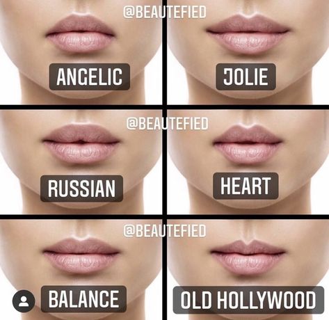 Types Of Lips Shape, Heart Shaped Lips, Lips Inspiration, Lip Types, Face Fillers, Botox Lips, Facial Fillers, Facial Aesthetics, Botox Fillers