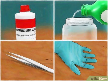 How to Get Ticks off Dogs (with Pictures) - wikiHow How To Remove Ticks From Dogs, Tick Removal Dog, Get Rid Of Ticks, Flea And Tick Spray, Ticks On Dogs, Tick Spray, Tick Removal, Tick Bite, The Tick