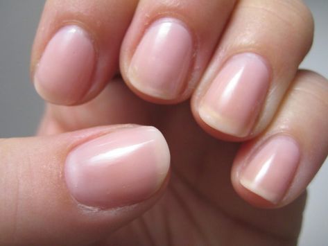 Japanese Manicure Emerald Nails, Easy Nails, Ingrown Toe Nail, Nail Cuticle, Easter Nails, Nail Health, Clear Nails, Nailed It, Healthy Nails