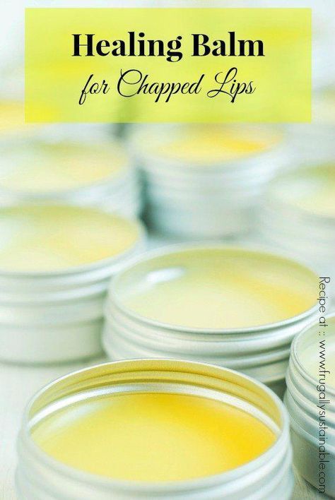 During the long, cold months of winter — when used daily — …this handcrafted healing balm will keep your lips from cracking and peeling. Not to mention, with its lovely blend of essential oils and all-natural, nourishing ingredients, it truly is a bargain! Healing Balm Ingredients 4 tablespoons plant-based oil (i.e. olive, coconut, sweet... Continue Reading Healing Lip Balm, Homemade Lip Balm Recipe, Diy Lip Balm Recipes, Make Up Gold, Lip Balm Recipes, Healing Balm, Diy Lotion, Homemade Lip Balm, Hand Balm