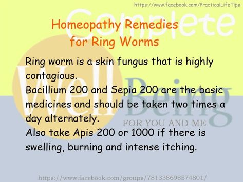 Practical Life Tips For You And Me: #Homeopathy #Remedies for #RingWorms Ring Worm, Herbal Medicine Recipes, Homeopathy Remedies, Natural Remedies For Migraines, Homeopathy Medicine, Alternative Healing, Homeopathic Medicine, Naturopathy, Alternative Therapies