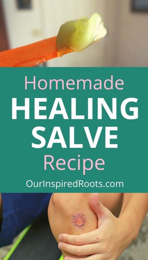 Homemade Healing Salve, Healing Salve Recipe, Homemade Salve, Antibiotic Ointment, Healing Salve, Salve Recipes, Home Remedies For Skin, Herbal Salves, Healing Salves