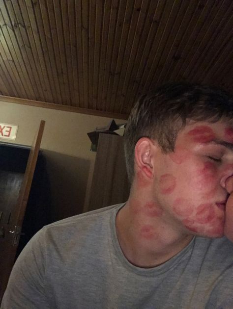 Couple goals, lipstick kisses, boyfriend, aesthetic Face Covered In Kiss Marks, Lipstick Marks On Boyfriend Face, Lipstick On Boyfriend Face, Swollen Lips After Kiss, Kiss Marks On Boyfriend, Lipstick Stains On Boyfriend, Kiss Lipstick Aesthetic, Love Bites Mark Aesthetic, Lipstick Kisses Boyfriend