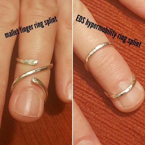 JewelSplint Finger Splint Rings Diy, Diy Finger Splint Ring, Ring Splints Hypermobility, Mallet Finger Splint, Ring Splints, Practical Jewelry, Mallet Finger, Finger Injury, Athena Dress