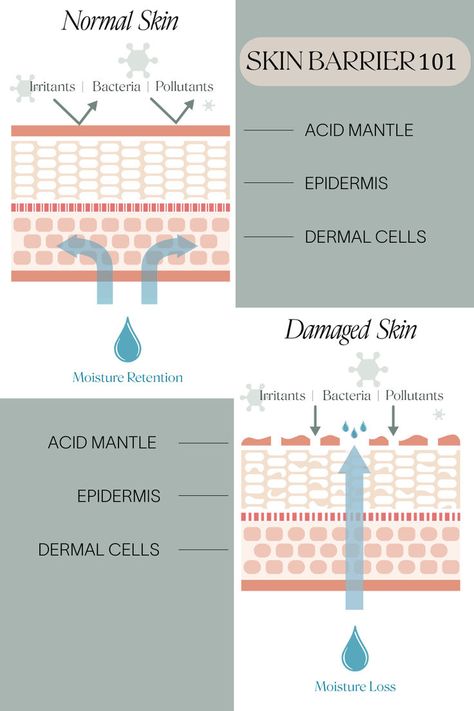 The skin barrier is composed of three primary elements:

Corneocytes: These are the dead skin cells in the top layer of your skin. They act as building blocks for the skin barrier.
Natural Moisturizing Factors (NMF): These are a combination of ceramides, cholesterol, fatty acids, and filaggrin that hold the corneocytes together. They are crucial for retaining moist
Signs of a Damaged Skin Barrier Skin Barrier Repair, Cosmetic Clinic, Healing Balm, Face Lotion, Skin Care Brands, Mineral Sunscreen, Skin Barrier, Simple Skincare, Radiant Skin