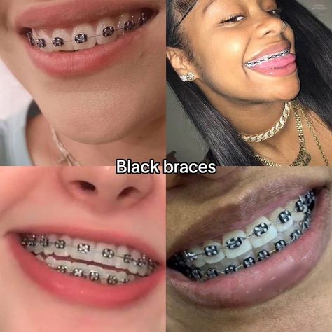 Braces Inspo Aesthetic, Black Braces Color, Cute Braces Colors For Brown Skin, Black Braces Aesthetic, Black Braces Teeth, Burgundy Braces, Braces Colours, Dental Braces Colors, Braces Colors Combinations