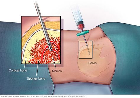 Medical School Essentials, Bone Marrow, Best Hospitals, Mayo Clinic, Medical Education, Medical Services