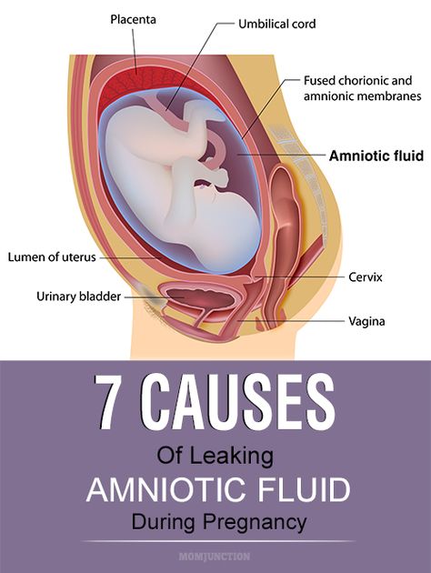 7 Serious Causes Of Leaking Amniotic Fluid During Pregnancy Pregnancy Anatomy, Womens Issues, Color Of Urine, 3rd Trimester Pregnancy, 11 Weeks Pregnant, 28 Weeks Pregnant, Medical Ultrasound, Amniotic Fluid, Pregnancy Checklist