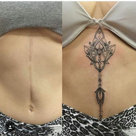 Excelente. Cubriendo cicatriz ❤❤ #tatuajes #tatuajes #tatuaje #tattoos #tattoo #ink Tattoo Belly Women, Stomach Scar Tattoo Cover Up, Belly Button Tattoos For Women, Lower Stomach Tattoos For Women, Belly Button Tattoos, Belly Button Tattoo, Dragon Tattoo Ideas, Tattoo Over Scar, Stomach Tattoos Women