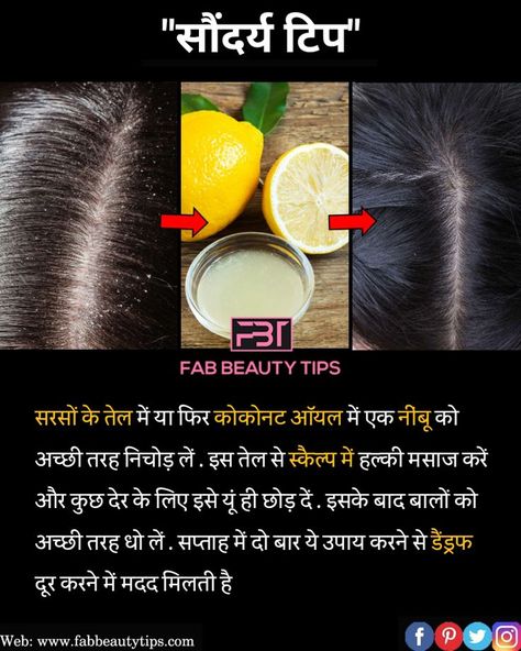 Remedy For Dandruff, Dandruff Solutions, Dandruff Remedy, Hair Care Remedies, Psychology Says, Hair Dandruff, Vitamins For Hair Growth, Diy Remedies, Homemade Remedies