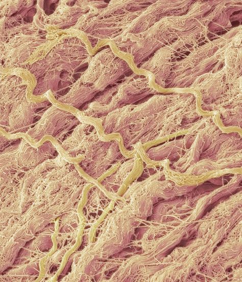 Dense Connective Tissue, Fibro Fog, Scanning Electron Micrograph, Human Tissue, Connective Tissue, Wax Strips, Complex Systems, Body Tissues, Body Organs