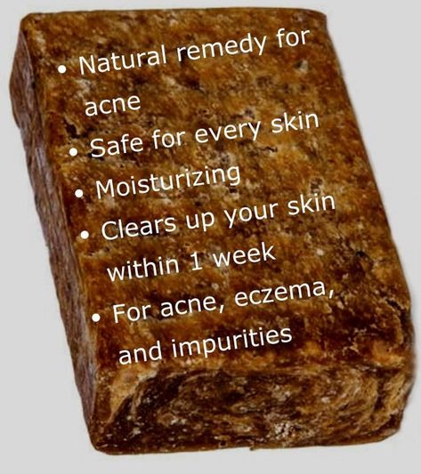 African Black Soap Benefits, Black Soap Benefits, Remedy For Acne, Raw African Black Soap, African Soap, Melanin Skin, Skin Facts, Skincare Acne, Black Skin Care