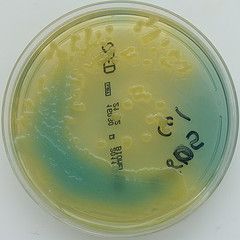 part 2 Klebsiella Pneumoniae, Microbiology