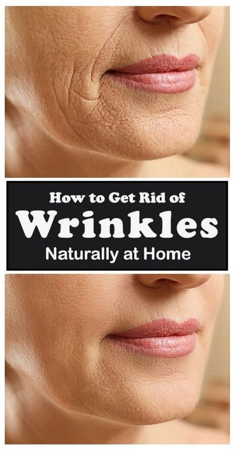 As the age increases with the passage of time, the skin begins losing its spring and wrinkles start appearing on our skin, which is a thing to be concerned about. But calm down! These simple and easy home medications may help one to deal with or at least reduce the wrinkles to some extent Be in […] Home Remedies For Wrinkles, Mouth Wrinkles, Get Rid Of Wrinkles, Wrinkle Remedies, Lip Wrinkles, Forehead Wrinkles, Skin Care Wrinkles, Face Wrinkles, Facial Exercises