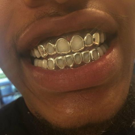 Gold Teeth Grills, Open Face Grillz, Girl Grillz, Pretty Teeth, Silver Grillz, Dental Jewelry, Grillz Teeth, Gold Grill, Diamond Teeth