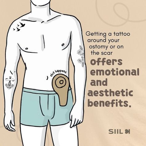 ✨ Turning scars into stories of strength and beauty ✨ Tattoos around an ostomy offer a unique way to shift our perspective on scars and stomas. Rather than seeing them as marks of the past, we can view them as symbols of our strength and resilience. Each design not only enhances your appearance but also tells a personal and powerful story 💪🏻💜 Always consult with your doctor before getting a tattoo to ensure it won’t affect the skin around the stoma or scar tissue. Your skin is precious, and... Ftm Top Surgery Scar Tattoo, Embrace Scar Therapy, Uterine Scar Tissue, Scar Be Prepared, Every Scar Tells A Story, Getting A Tattoo, Scar Tissue, Beauty Tattoos, Get A Tattoo