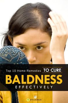 Top 10 Home Remedies, Brown Spots On Face, Home Remedies For Hair, Spots On Face, Essential Oils For Hair, Hair Remedies, Utila, Frizzy Hair, Hair Removal