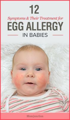 Egg allergy is common in babies whose immune system has not developed to sustain protein content present in it. Know more about egg allergy in babies.  Check out how I got rid of my allergies at https://organicallergyrelief.com/ Egg Allergy Symptoms, Allergy Rash, Baby Food Allergies, Diet Dishes, Egg Allergy, Egg Free Recipes, Allergy Testing, Newborn Hacks, Food Allergens