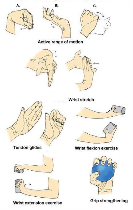 Carpal Tunnel Relief Exercises, Carpal Tunnel Remedies, Hand Therapy Exercises, Carpal Tunnel Exercises, Carpal Tunnel Surgery, Carpal Tunnel Relief, Wrist Exercises, Occupational Therapy Activities, Physical Therapy Exercises