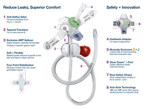 J Tube Feeding, Enteral Feeding, Medical Grade Silicone, Feeding Tube, Low Profile, Health Care, Medical, Balloons, Thing 1