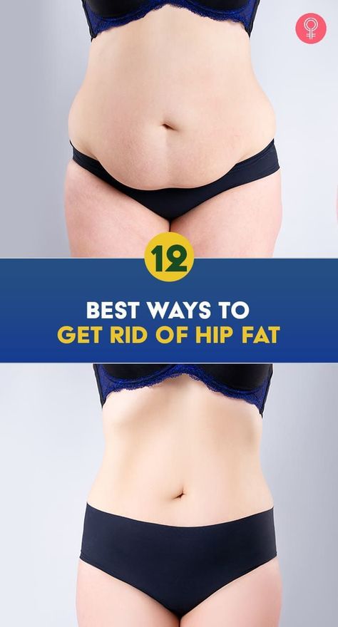 12 Best Ways To Get Rid Of Hip Fat: Firm and round buttocks are not only aesthetically pleasing but also improve posture and support the core. Keep reading to learn some ways to shed the excess fat from your hips and prevent it from sagging. Slim Hips, Reduce Body Fat, Diet Vegetarian, Improve Posture, Burn Belly Fat, Lose Body Fat, Belly Fat Loss, Fat Burner, Fat Fast