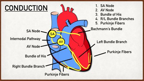 Cardiac Conduction System, Brugada Syndrome, Cardiac Muscle Cell, Ekg Rhythms, Cardiology Nursing, Ekg Interpretation, P Wave, Cardiac Nursing, Atrial Fibrillation