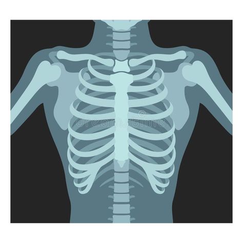 Thorax x-ray. Lungs radiological control. Radiography of chest, ribs., torso. Fl #Sponsored , #Affiliate, #Ad, #Lungs, #Thorax, #control, #radiological X-ray Images, Human Skeleton, Body Design, Radiology, Drawing Prints, Design Background, X Ray, Poster Art, Stock Vector