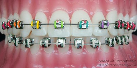 Rainbow braces. #braces #orthodontics Philbin & Reinheimer Orthodontics in Annapolis, Maryland and Stevensville, MD. Rainbow Braces, White Braces, Cute Braces Colors, Kids Braces, Braces Tips, Getting Braces, Cute Braces, Color Correcting Concealer, Brace Face