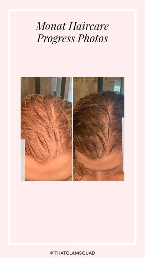 Monat Before And After, Baddie Quotes, Hair Inspo, Hair Care, Quotes, Hair, Quick Saves, Hair Care Tips