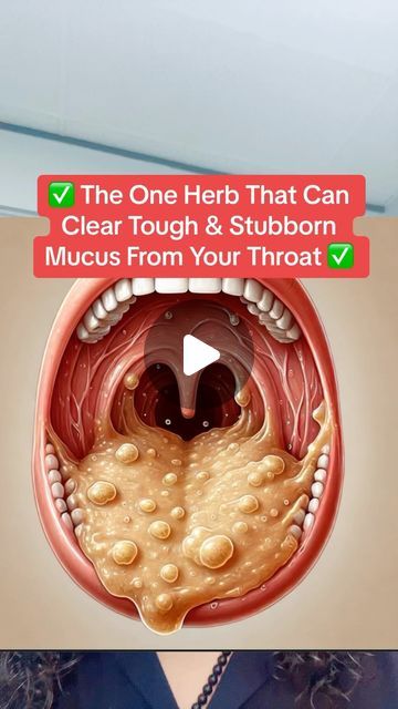 Raw (Mourab) Maraby on Instagram: "✅The One Herb That Can Clear Tough &
Stubborn Mucus From Your Throat✅ #mucus #drythroat #cough #phlegm" Throat Mucus Remedy, Natural Remedy For Cough And Mucus, Herbs For Sinuses, How To Get Mucus Out Of Throat, Stubborn Cough Remedies, Mucus Relief Remedies How To Get Rid, How To Get Rid Of Mucus In Chest, Phlegm Remedy Get Rid Of, Best Remedy For Cough