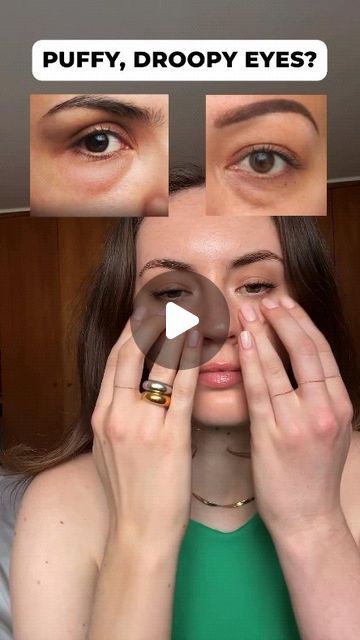 Beauty Facial Yoga on Instagram: "Drop ❤️ if you want more posts like this
🌿
Great content by @allyoucanface . Follow her for more!
🌿
.
🌟✨ Repeat After Me to Reduce Puffiness and Dark Circles Around the Eyes ✨🌟

Incorporate this gentle massage into your routine to rejuvenate your eye area:

1️⃣ Place your ring fingers on the inner corners of your eyes.
2️⃣ Gently glide your fingers outwards along the under-eye area towards your temples.
3️⃣ Use light pressure to avoid tugging on the delicate skin.
4️⃣ Repeat this motion several times, focusing on a smooth, continuous glide.

By regularly performing this massage, you can help to reduce puffiness and dark circles, leaving your eyes looking refreshed and revitalized. 🌿💆‍♀️

#ReducePuffiness #DarkCircles #FacialMassage #FaceYoga #AllYouC Puffy Eyes Massage, How To Reduce Puffy Eyes, Droopy Eyes, Repeat After Me, Dark Eye Circles, Beauty Facial, Facial Yoga, Poor Circulation, Face Exercises