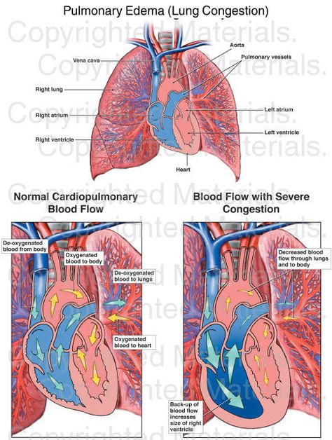 Careers Ideas, Emt School, Nursing Facts, Emt Study, Medical Assisting, Lung Anatomy, Diagnostic Medical Sonography, Nursing Board, Nursing Study Guide