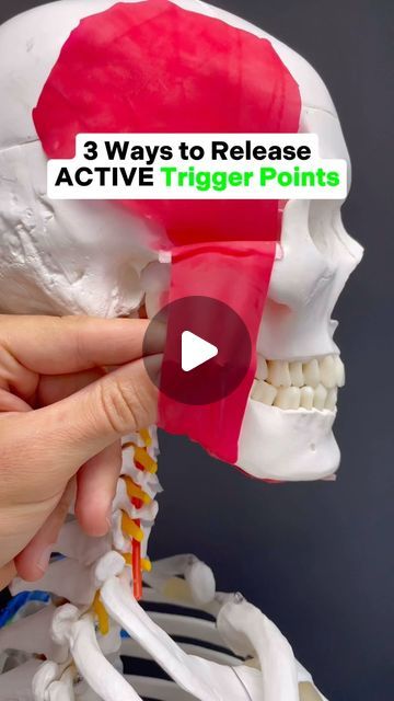 Face Trigger Points, Trigger Point Therapy Muscle Knots, Jaw Massage Trigger Points, Lock Jaw Relief, Jaw Muscle Release, Myofascial Release Trigger Points, Tmd Relief, Dry Needling Trigger Points, Tmj Relief Remedies