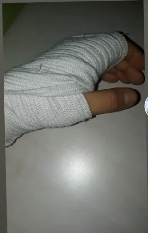 Fractured Hand Pic, Fracture Photo, Hand Fracture, Bandaged Hands, Purple Hijab, Beautiful Morning Pictures, Hospital Room Snapchat Stories, Moon And Stars Wallpaper, Fake Photo Short Hair