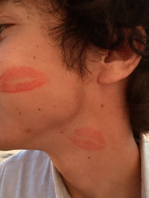 Lip Mark Kisses Aesthetic, Red Lip Stain Aesthetic, Lipstick Kisses On Bf, Lipstick On Cheek Couple, Bf Kiss On Cheek, Guy With Lipstick Marks, Lipstick Marks On Boyfriend Aesthetic, Kisses All Over Face Makeup, Lipstick On Bf Face