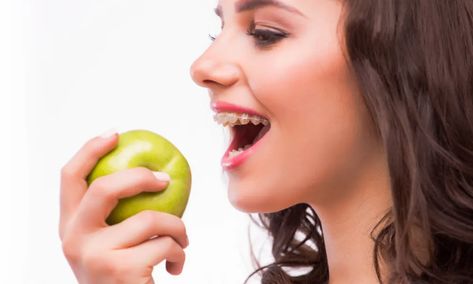 What Foods can You Not Eat with Braces? What To Eat With Braces, Teeth Diseases, Fiber Bread, Getting Braces, Orthodontic Appliances, Discolored Teeth, Pureed Soup, Metal Braces, Front Teeth