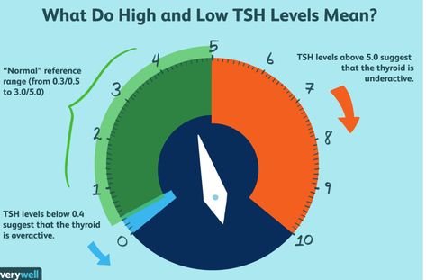 What Do High and Low TSH Levels Mean? Low Tsh, High Tsh Levels, Thyroid Test Results, Thyroid Levels, Overactive Thyroid, Thyroid Imbalance, Thyroid Test, Low Thyroid, Thyroid Medication