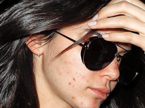 15 Latest Kendall Jenner without Makeup Images | Styles At Life Kendall Jenner No Makeup, Khloe Kardashian Without Makeup, Kendall Jenner Without Makeup, Kendall Makeup, Kendall Jenner Plastic Surgery, Kendall Jenner Acne, Kim Kardashian Without Makeup, Kendall Jenner Skin, Kendall Jenner Maquillaje