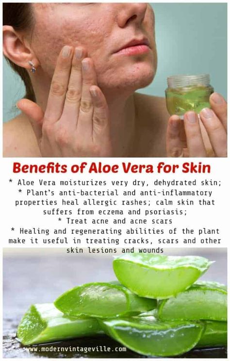 7 Amazing Homemade Beauty Products with Aloe Vera Aloe Vera Recipes, Benefits Of Aloe Vera, Aloe Vera For Skin, Aloe Vera Skin Care, Brown Spots Removal, Homemade Beauty, Dehydrated Skin, How To Treat Acne, Homemade Beauty Products