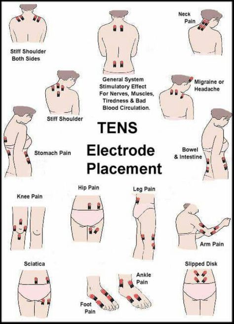 Tens Unit for All Areas of Pain                              … Tens Electrode Placement, Tens Unit Placement, K Tape, Tens Unit, Ten Unit, Hip Pain, Sciatica, Occupational Therapy, Knee Pain