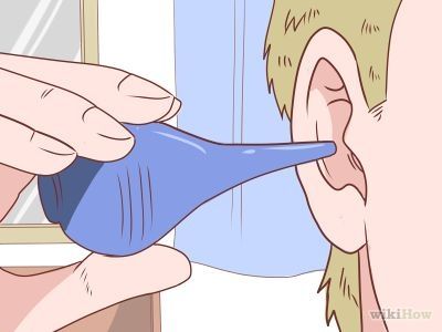 How to Deep Clean Your Ears -- via wikiHow.com Clean Ear Wax Out, Saline Rinse, Impacted Ear Wax, Earwax Candle, Ear Cleaning Wax, Clogged Ears, Vertigo Exercises, Ear Wax Buildup, Ear Candling