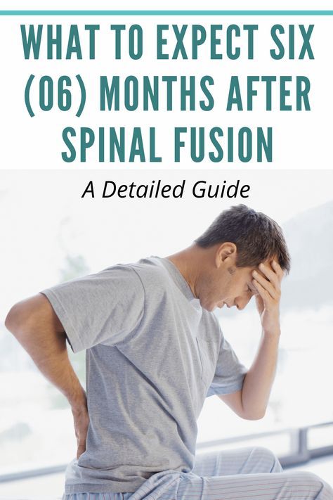 Stenosis Of The Spine, Spinal Degeneration, Sciatic Nerve Stretches, Spinal Fusion Surgery, Spinal Fusion, Spinal Decompression, Spinal Surgery, Spinal Nerve, Back Stretches For Pain