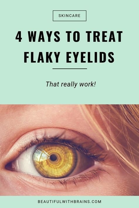 Click this pin to learn 4 effective ways to treat dry, flaky eyelids. #skincare #skincaretips #dryskin Oily Eyelids How To Get Rid Of, How To Get Rid Of Eye Floaters, Dry Eyelids Remedy, Dry Flaky Eyelids, Diy Eye Drops For Dry Eyes, How To Lift Eyelids Naturally, Dry Skin Around Eyes, Itchy Eyelids, Dry Patchy Skin