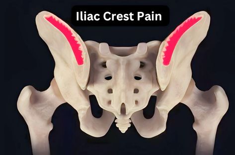 Relieve Iliac Crest Pain: Up To Date Treatments
 



Various factors, such as overuse or injury, can cause pain over the iliac crest. Consulting a healthcare professional Iliac Crest, Enjoying Life, Pain Free, Healthcare Professionals, Say Goodbye, Get Back, Up To Date, Back Pain, Pain Relief